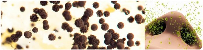 Les spores de moisissure nuisent au système respiratoire